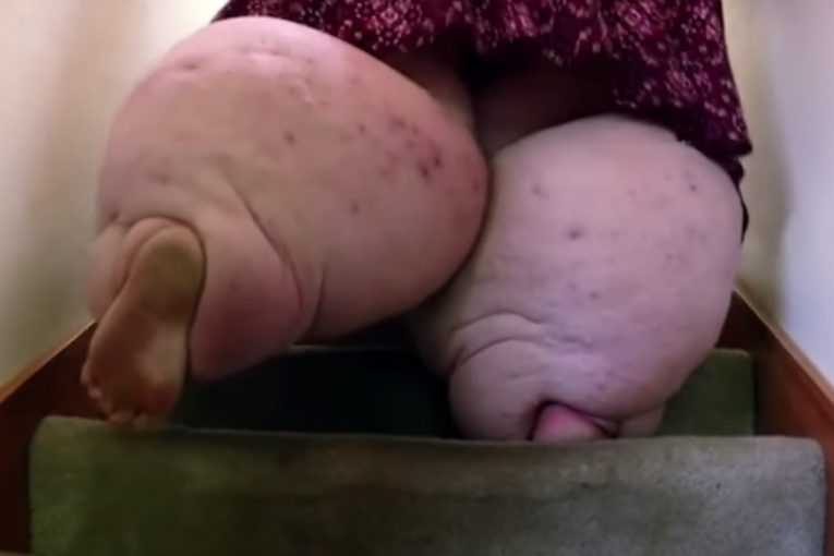 Pokušava da se popne uz stepenice