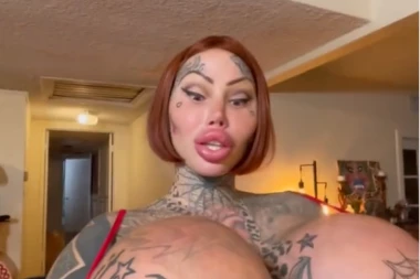 VLASNICA NAJDEBLJE INTIMNE REGIJE I GRUDI NA SVETU SADA IMA PROBLEM: Pogledajte spisak svih operacija koje je uradila, zbog jedne umalo UMRLA