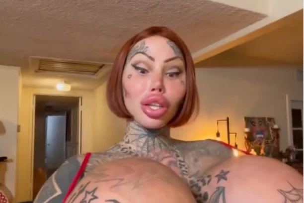 VLASNICA NAJDEBLJE INTIMNE REGIJE I GRUDI NA SVETU SADA IMA PROBLEM: Pogledajte spisak svih operacija koje je uradila, zbog jedne umalo UMRLA