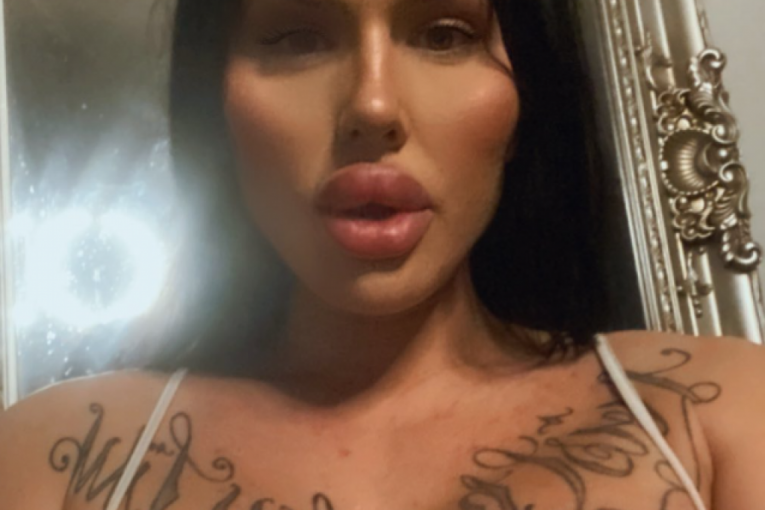 Sofia nakon urađenih usana