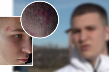 PRESRELI GA KOLIMA KAD JE IZAŠAO IZ KUĆE I PRETUKLI: Prvo ga pitali nešto na albanskom, pošto nije znao da odgovori zaključili da je Srbin! Otac pretučenog dečaka - MODAR JE I UPLAŠEN!