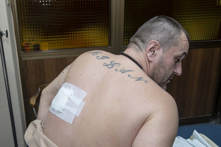 Rana Miljana Delevića