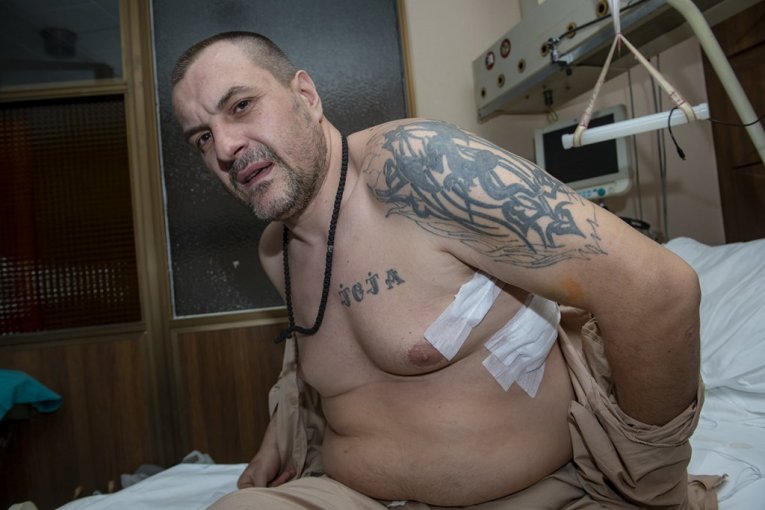 Miljan Delević ranjeni Srbin s Kosova