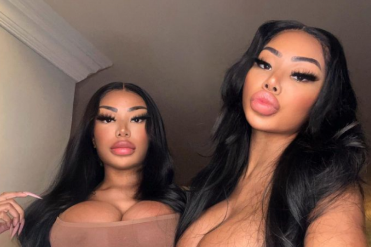 Šenon Šanejd bliznakinje