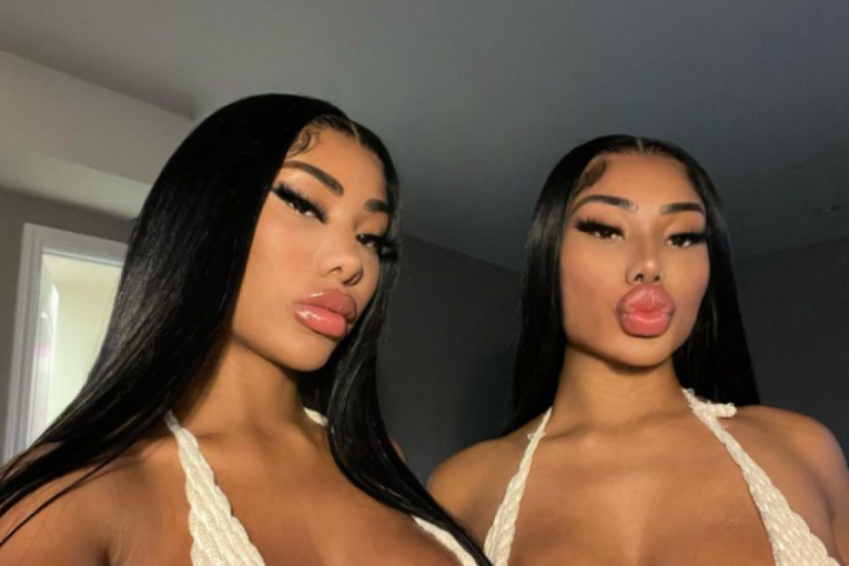 Šenon i Šanejd u belom gornjem delu