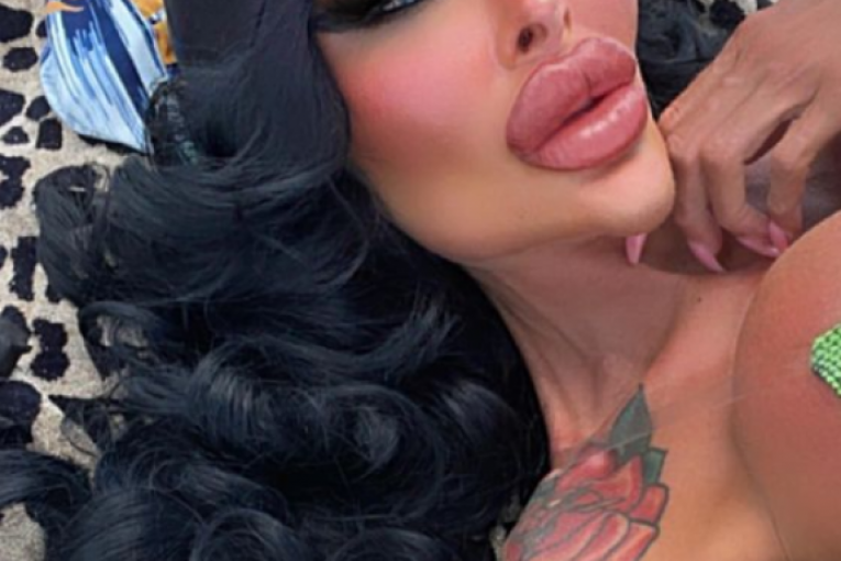 Tara nakon svih operacija