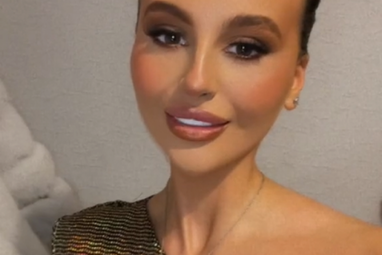 Nia uradila turske zube