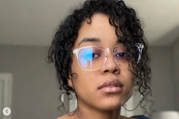 OVA MANEKENKA KRIJE TAJNU OD JAVNOSTI: Zbog ovoga je nazivaju NAKAZOM, svi gledaju u njeno telo u neverici!