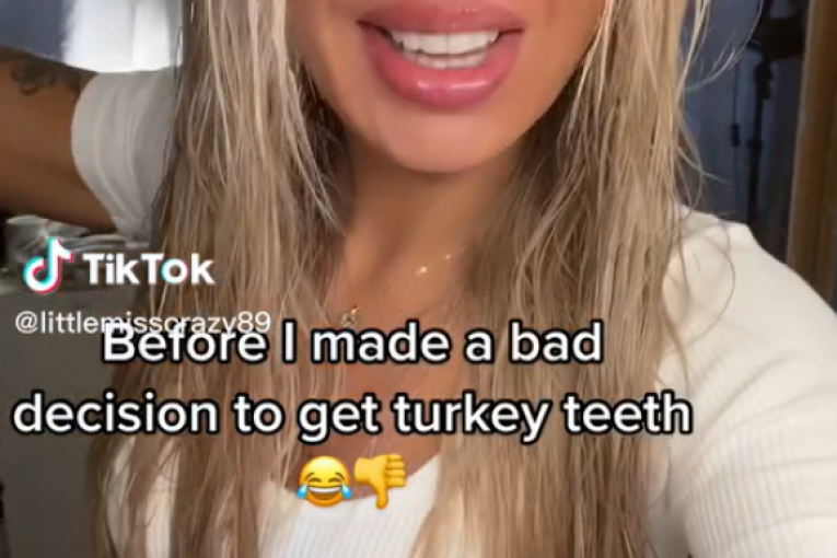 Devojka koja je uradila zube u Turskoj priča svoje iskustvo