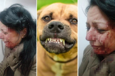 UHAPŠENI VLASNICI PASA KOJI SU IZUJEDALI ŽENU U BORU: Razvlačili je po zemlji i krvnički grizli po licu!