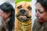 UHAPŠENI VLASNICI PASA KOJI SU IZUJEDALI ŽENU U BORU: Razvlačili je po zemlji i krvnički grizli po licu!