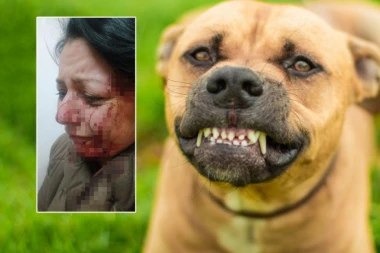 ŽENA DO DETALJA OPISALA KRVOLOČNI NAPAD ZVERI U BORU: Oborili su me na zemlju, krenuli da kidišu i UJEDAJU po glavi! (FOTO)