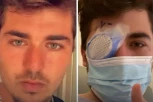 NAPRAVIO JEDNU GREŠKU PRED SPAVANJE PA OSLEPEO: "Pojeli" mu oko, dečko (21) preživljava pakao!