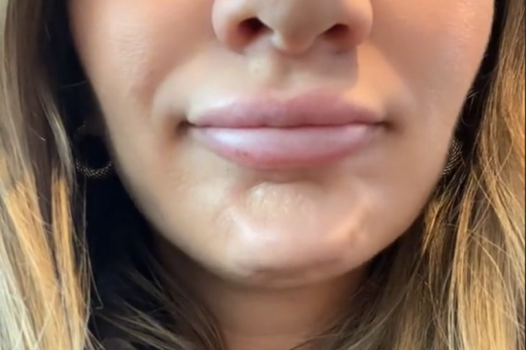 Megan pokazuje bradu