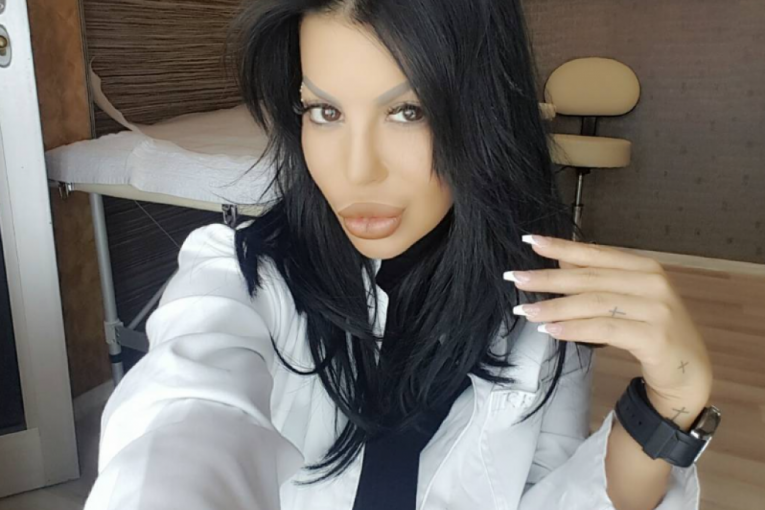 Žana Đorđević pre estetskih korekcija