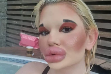 BUGARSKA BRATZ LUTKA POSLE NAJVEĆIH USANA POSTAVLJA NOVI REKORD U SVETU: Lekari ne mogu da je ZUSTAVE, upozorovaju da će posledice biti FATALNE!