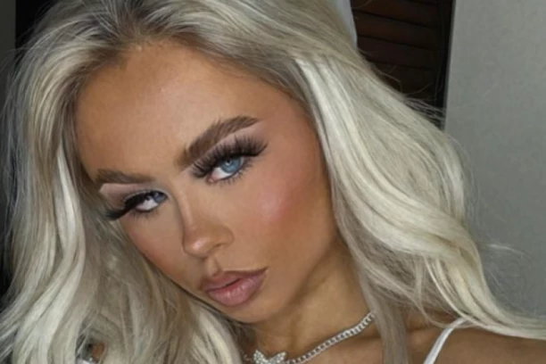 DEVOJKA JE POLUSLEPA POLOŽILA VOŽNJU I INSTRUKTOR TVRDI DA JE ODLIČNA! Ljudi besni: "Sklanjajte je sa puta"