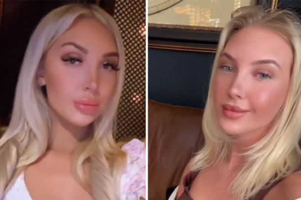 HTELA SAMO MALU KOREKCIJU USANA, PA JE USLEDIO PAKAO: Desilo se nešto strašno, niko ne veruje kako je prošla! (FOTO/VIDEO)