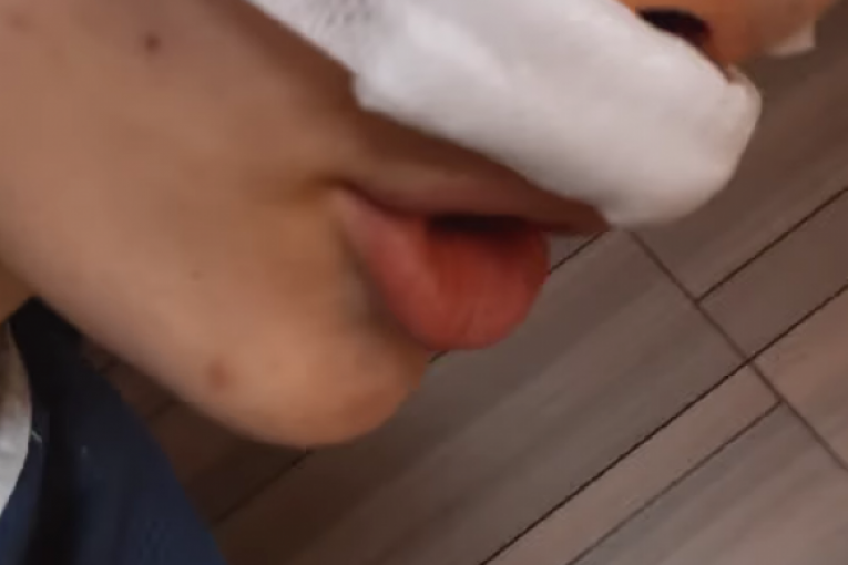 Uki Q nakon operacije