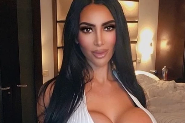 PREMINULA DVOJNICA KIM KARDAŠIJAN TOKOM PLASTIČNE OPERACIJE: Zbog jedne skoro nage fotografije svi su je RAZAPELI i poručivali da je PROMAŠAJ! (FOTO)