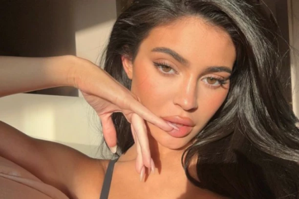 SVI GLEDAJU U USNE KAJLI DŽENER! Godinama se pućila, a onda PEH - fanovi oduševljeni "Izgledaš NORMALNO"