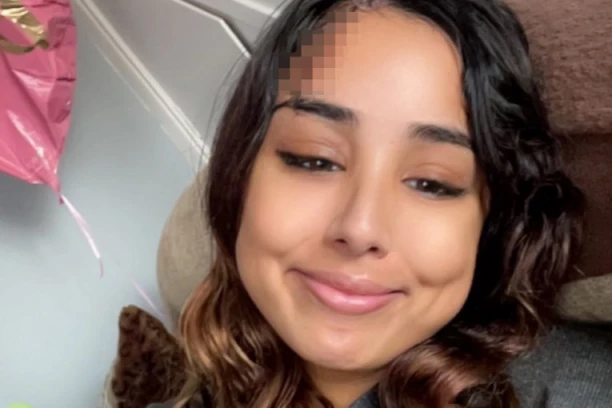 ŠNALA ZA KOSU JE UMALO UBILA: Žena unakazila lice - Pakao od bolova, evo šta joj se desilo HOROR! (FOTO)