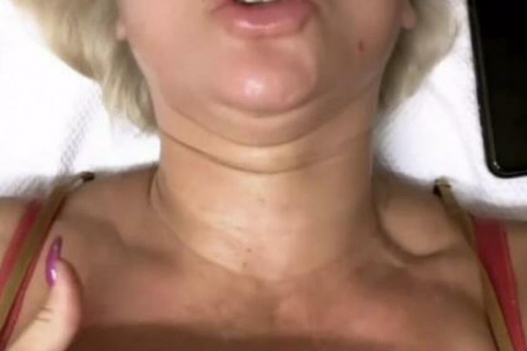 Goca Tržan na tretmanu pokazala grudi u spavaćici