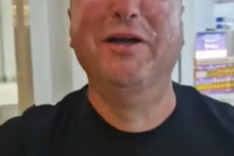 Đani ima opekotine trećeg stepena