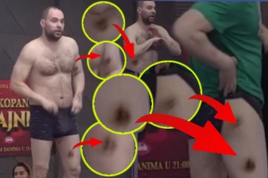 SLAVNIĆ KRIJE TEŠKU BOLEST: Zvezdan izbrojao 70 modrica, pa zakukao: "Sahranite me blizu Ksenije!"