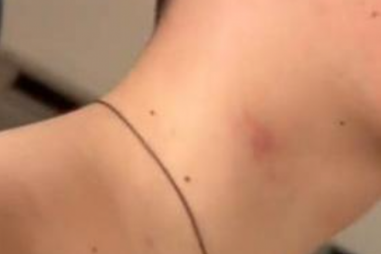 Brat (15) Kristine Spalević pretučen, prevezen u Urgentni centar