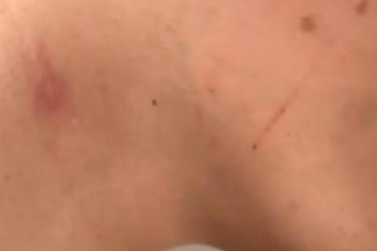 Brat (15) Kristine Spalević pretučen, prevezen u Urgentni centar