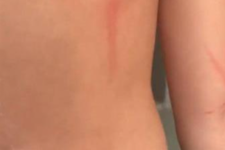 Brat (15) Kristine Spalević pretučen, prevezen u Urgentni centar