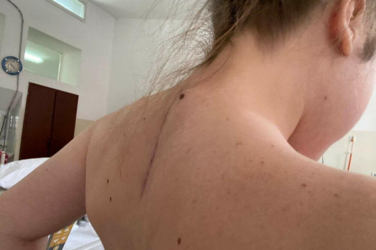 Mina Pošarac nakon operacije