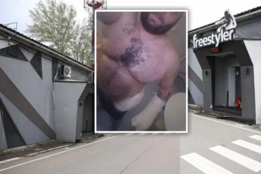 STARA JE TO KU*VA! Darko pokazao rane koje je dobio u pucnjavi kod Fristajlera: Čekam operaciju i ljubim cvetiće! (FOTO)