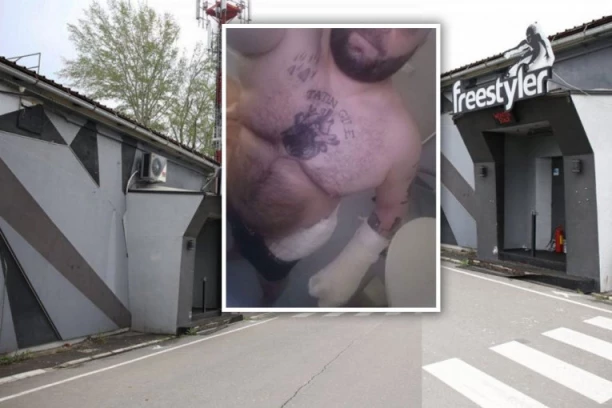 STARA JE TO KU*VA! Darko pokazao rane koje je dobio u pucnjavi kod Fristajlera: Čekam operaciju i ljubim cvetiće! (FOTO)