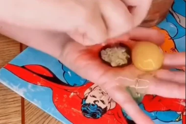 LJUDI U ŠOKU! Žena pokazala rupu na ruci i kako u nju gura pirinač i puter od kikirikija! NAROD JE PITA ODAKLE JOJ "TO NA DLANU"! (VIDEO)