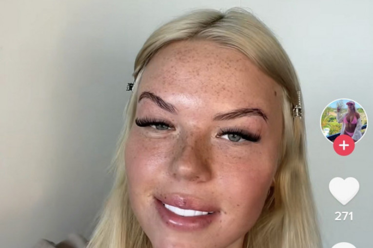 Laura priča o operacijama na TikTok - u
