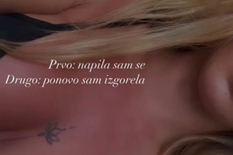 Teodora Džehverović izgorele grudi