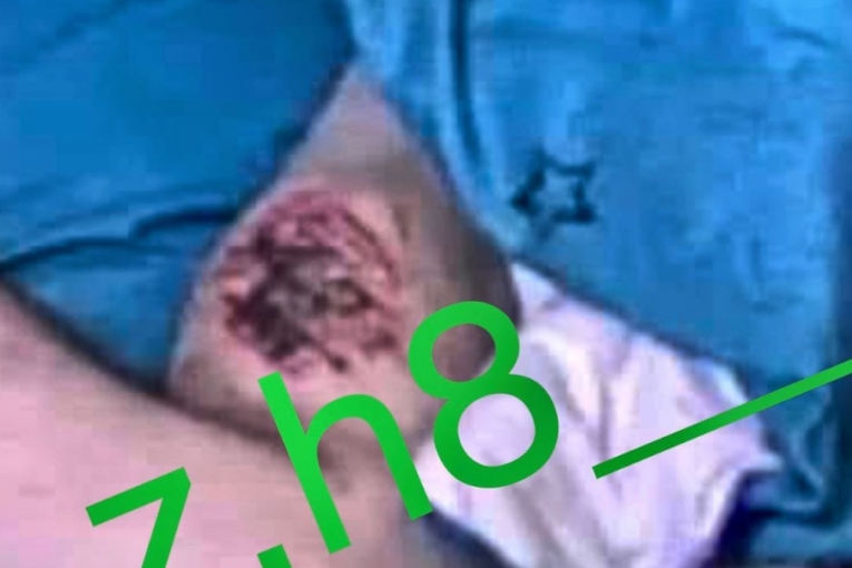 Zvezdan Slavnić rana na nozi Zadruga 6