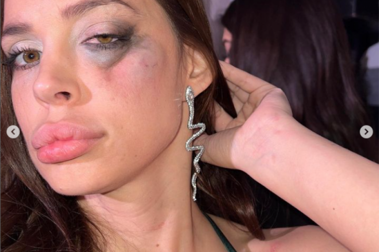 Nataša Šavija se nakon prebijanja vratila na svadbu