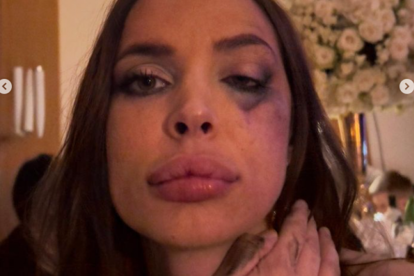 Nataša Šavija se nakon prebijanja vratila na svadbu