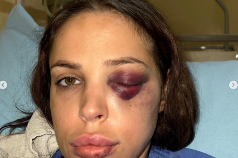 Nataša Šavija u bolnici