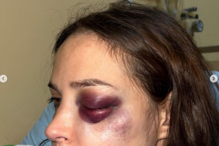 Nataša Šavija u bolnici