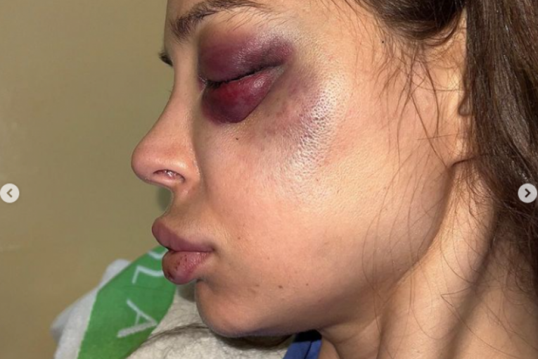 Nataša Šavija u bolnici