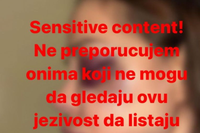 Upozorenje na materijal