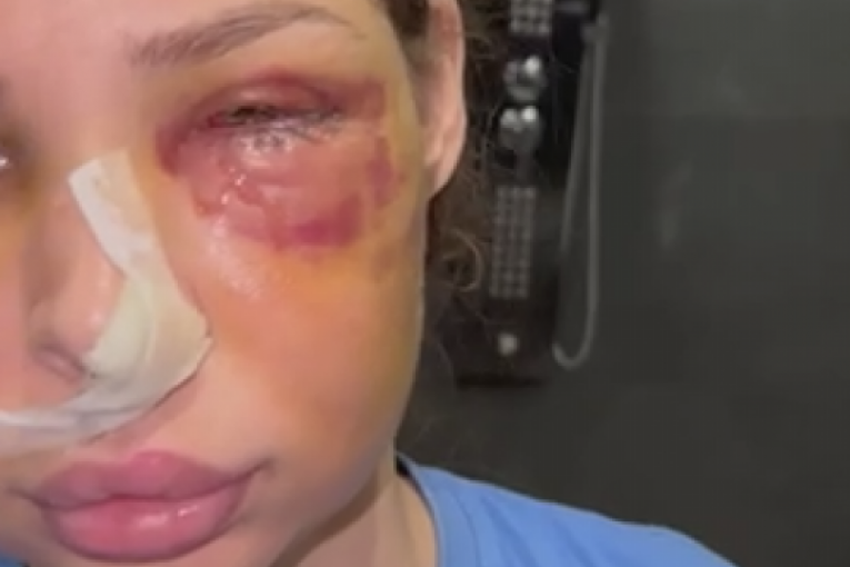 Pretučena Nataša Šavija nakon operacije