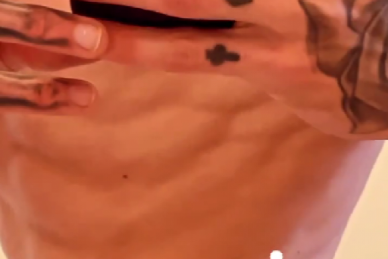 Fran Pujas se skinuo