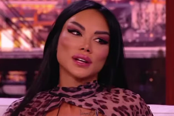 "KAŽU DA SAM KAO AVATAR" Procurila fotka Tamare Đurić pre svih OPERACIJA, popularna voditeljka se ŠOKIRALA! (FOTO)