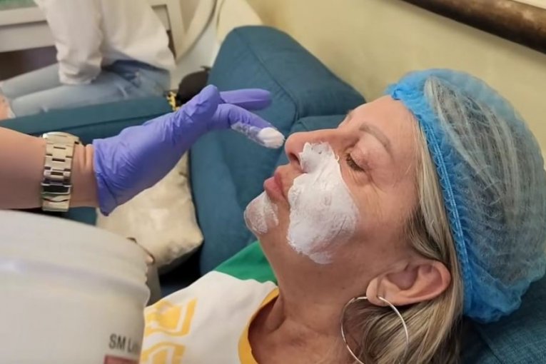 Biljana Dragojević radi botoks lica