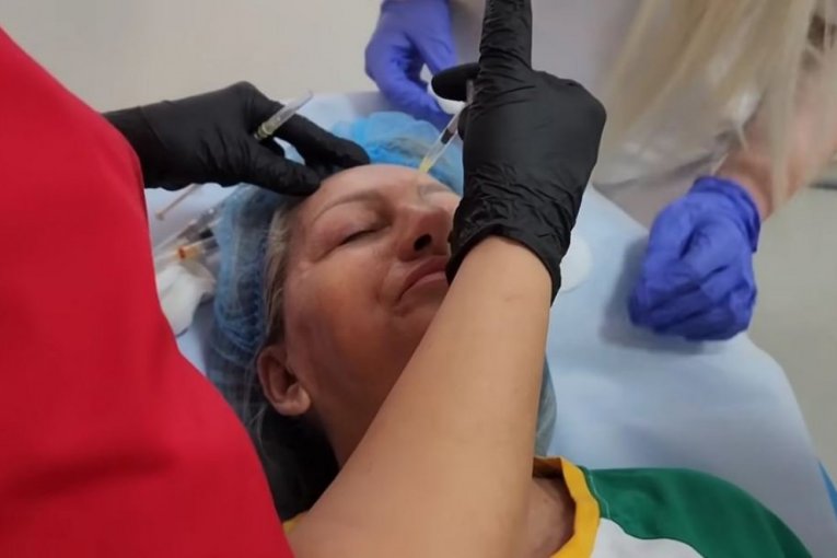 Biljana Dragojević radi botoks lica